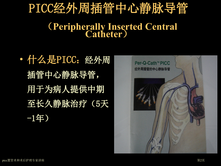 picc置管术和术后护理专家讲座.pptx_第2页