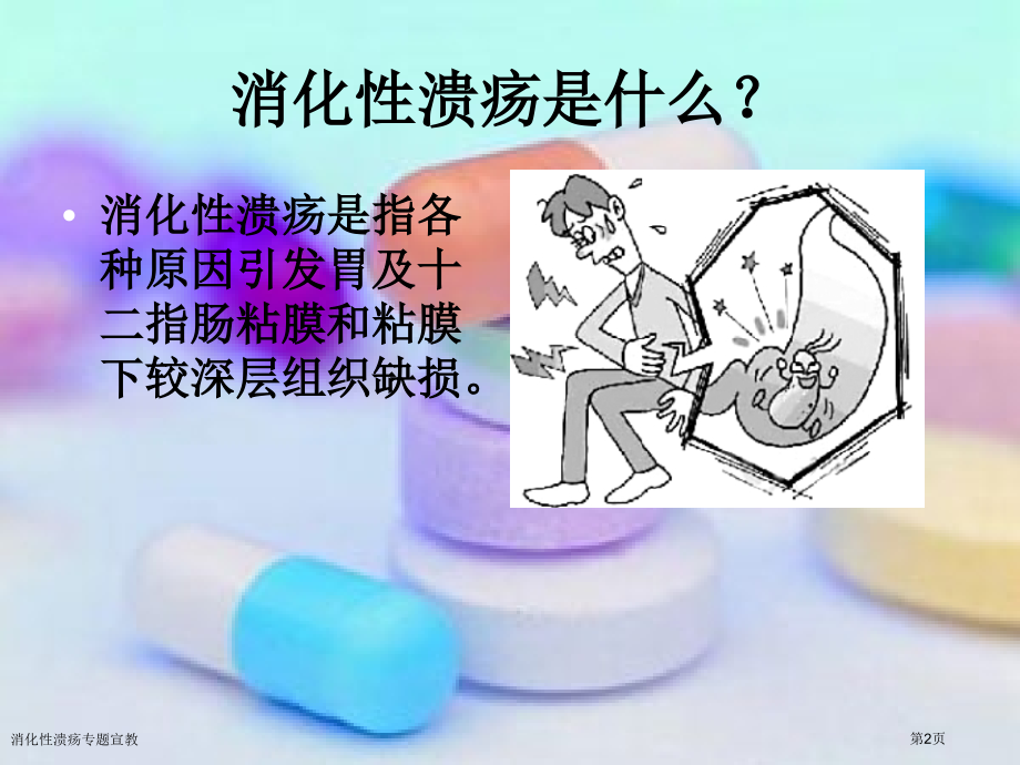 消化性溃疡专题宣教.pptx_第2页