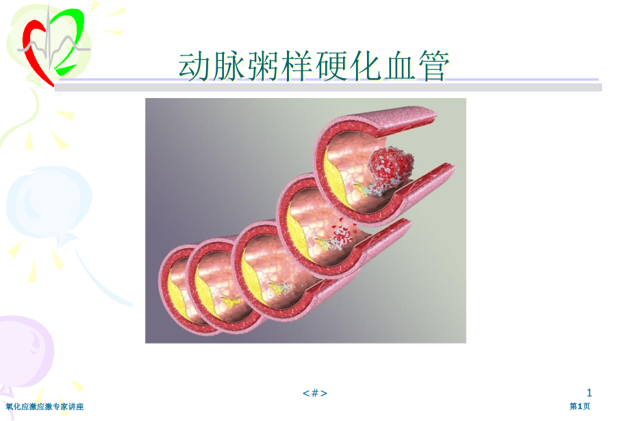 氧化应激应激.pptx_第1页