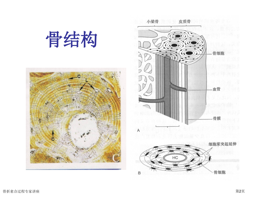 骨折愈合过程专家讲座.pptx_第2页