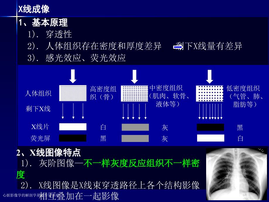 心脏影像学的解剖学基础.pptx_第1页