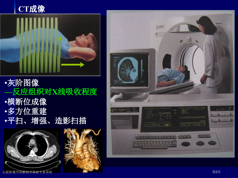 心脏影像学的解剖学基础.pptx_第2页