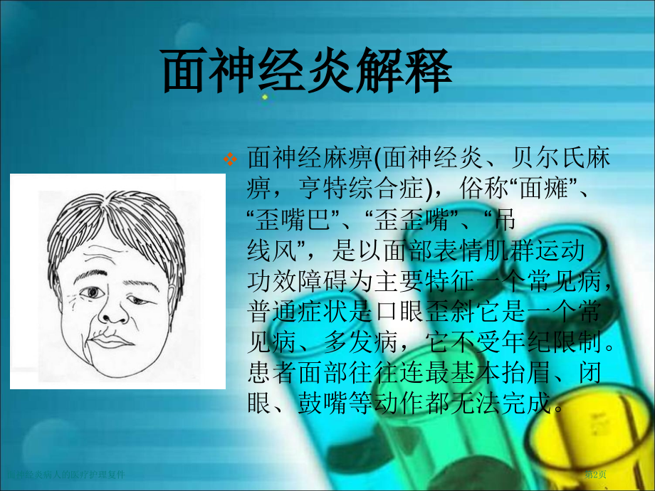 面神经炎病人的医疗护理复件.pptx_第2页