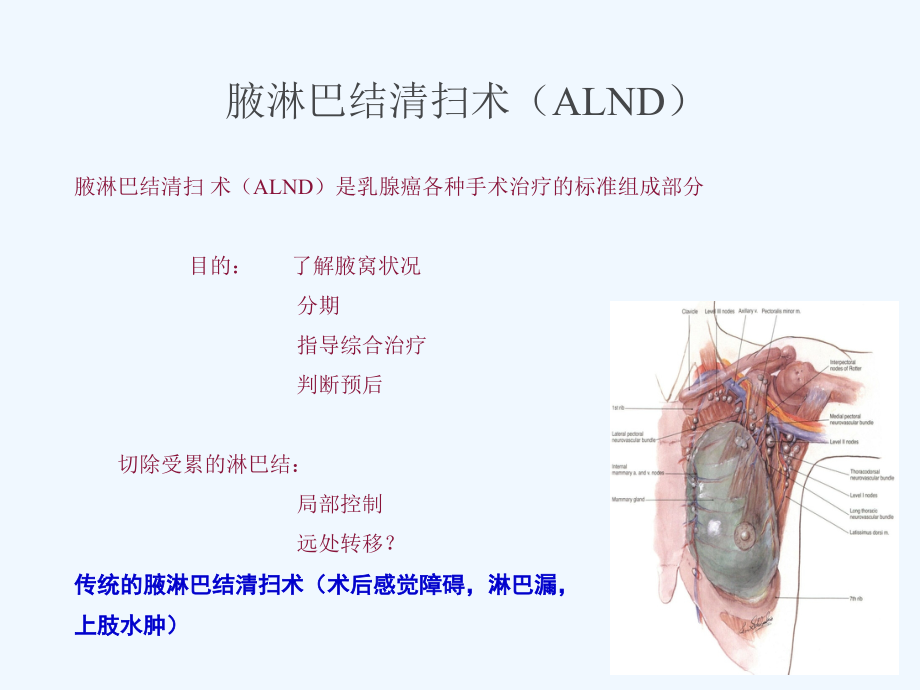NCCN指南解读前哨淋巴结活检.ppt_第2页