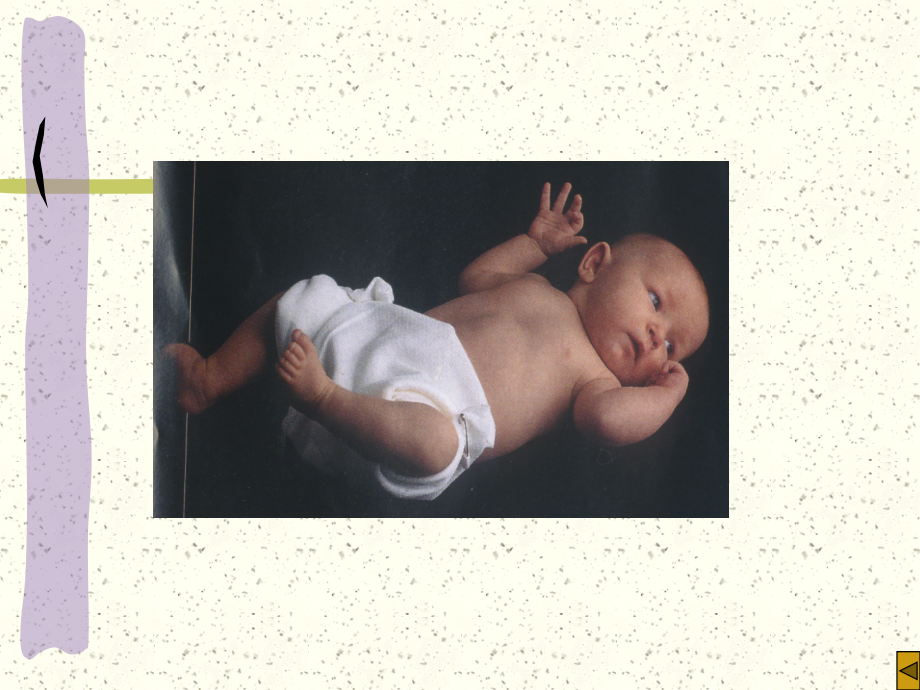 第8章-2液体疗法pp.ppt_第2页