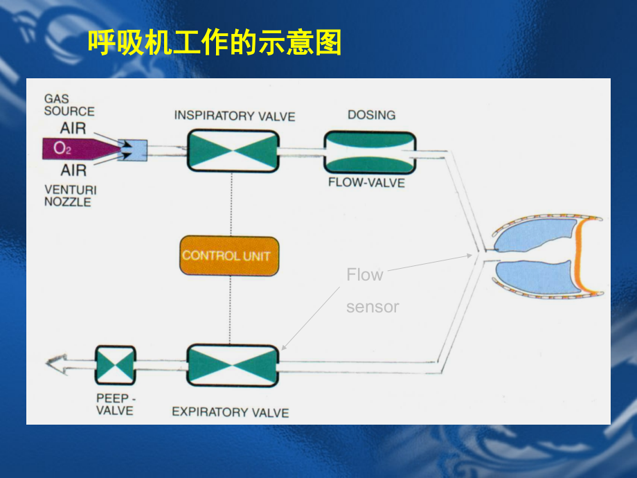 机械通气波形分析-上海一院.ppt_第2页