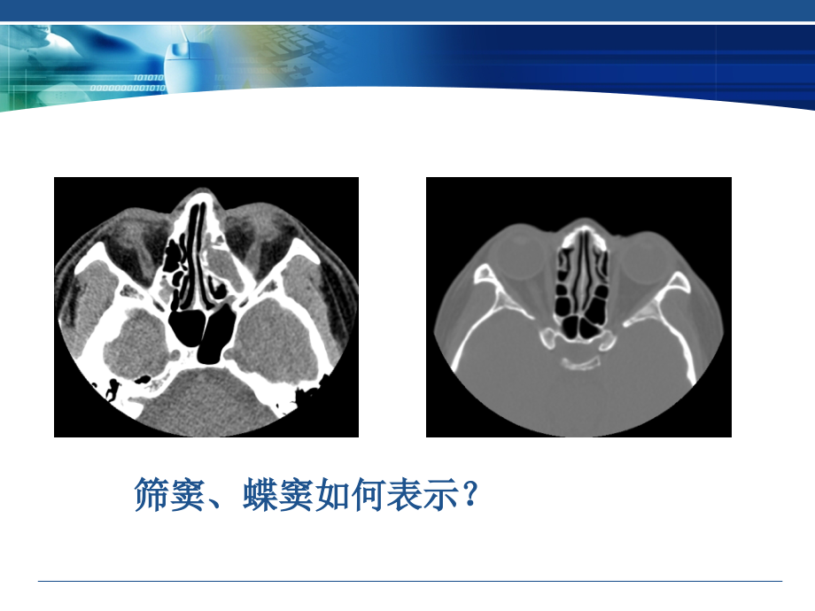 医学图像处理与分析第七章-医学图像信息提取及分析.ppt_第2页