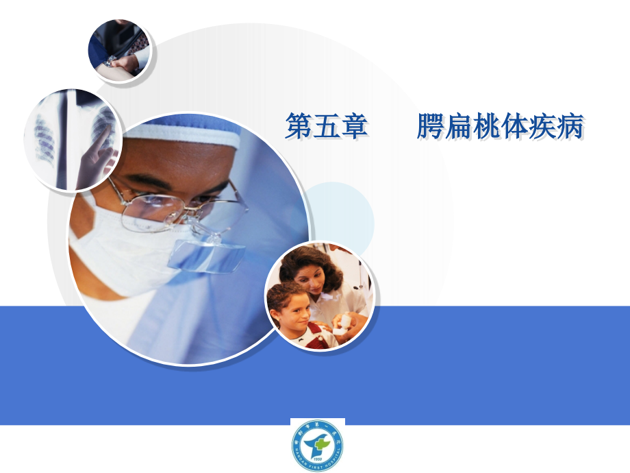第五章-----腭扁桃体疾.ppt_第1页