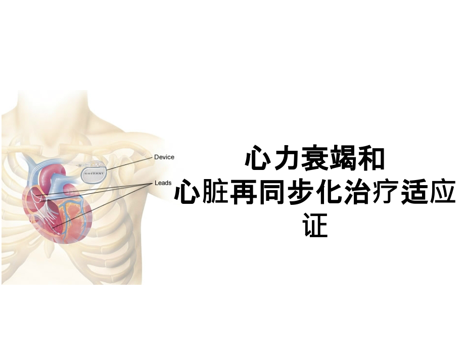 CRT适应症和临床研究进展简介.ppt_第1页