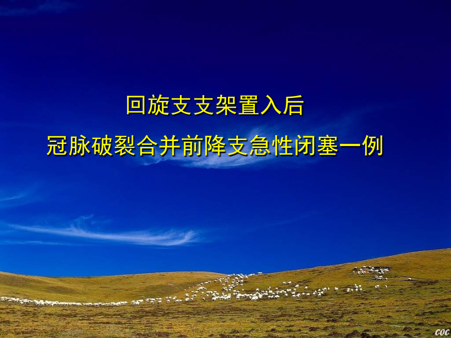 回旋支支架置入后冠脉破裂合并前降支急性闭塞一例.ppt_第1页