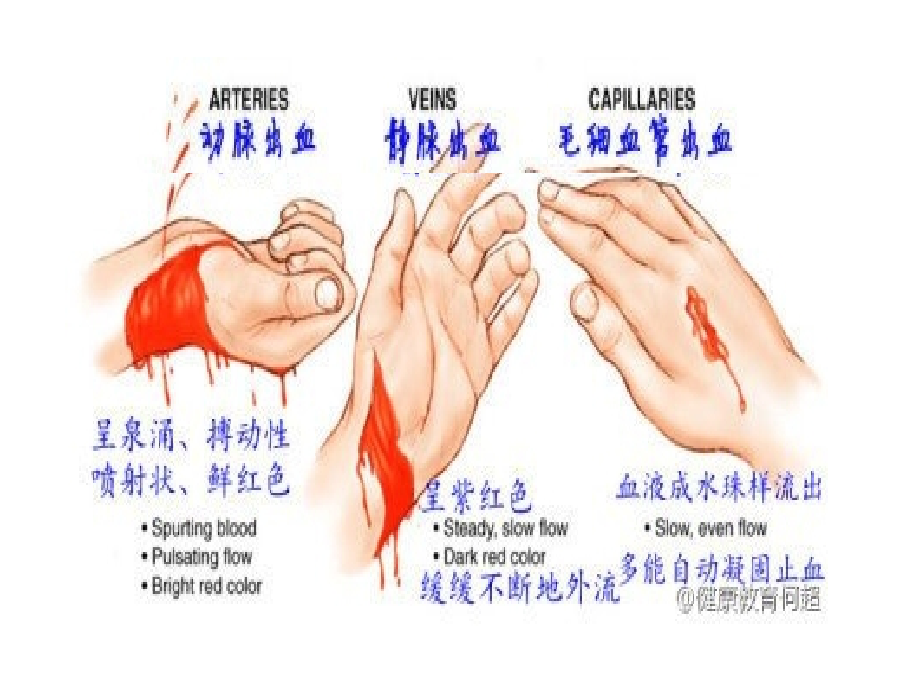 4-4-2血流的管道——血管.ppt_第2页
