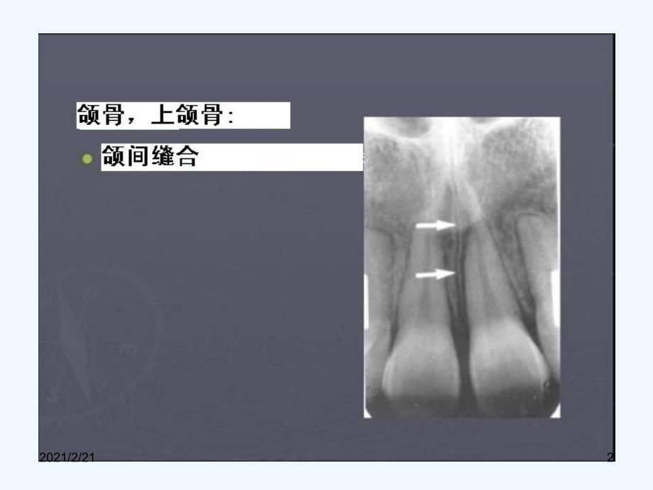 影像式样图片.ppt_第2页