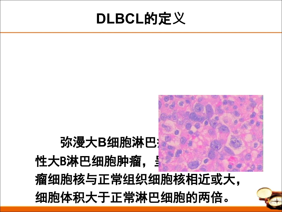 医学我国弥漫大B细胞淋巴瘤诊治指导建议.ppt_第2页
